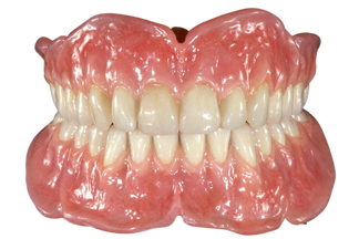 Ms dental arts Removable denture