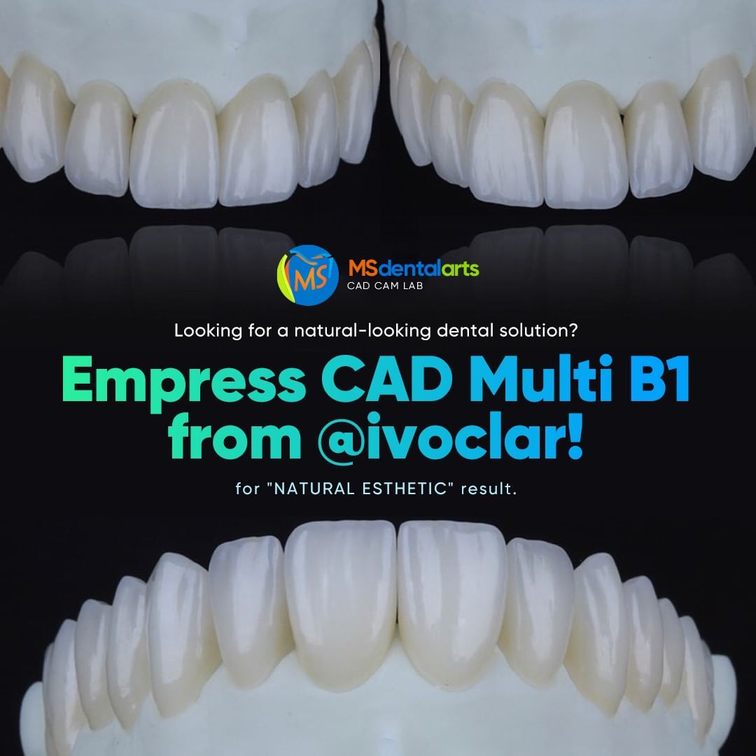 empress multi cad b1 from ivoclar